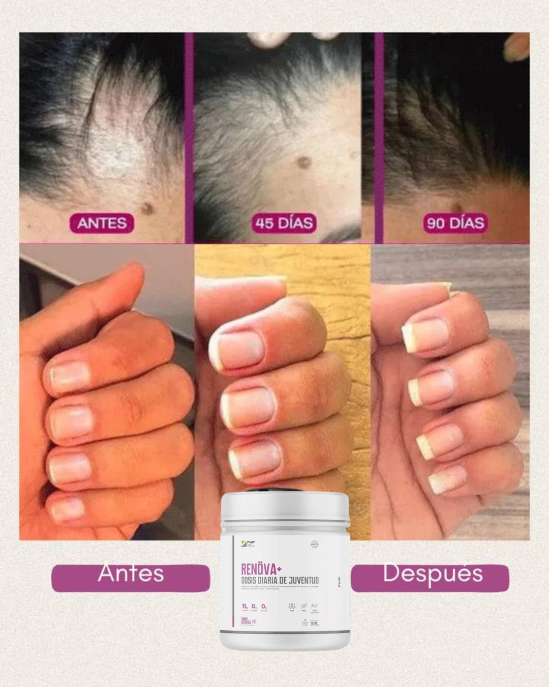 💎 RENOVA: Despierta tu Belleza desde Adentro hacia fuera