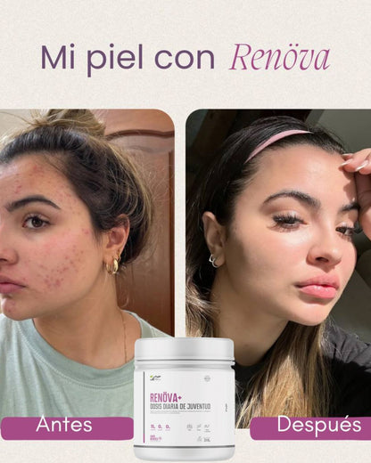 💎 RENOVA: Despierta tu Belleza desde Adentro hacia fuera
